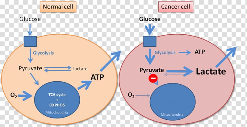 Warburg effect Cancer Warburg hypothesis Glycolysis Metabolism, technology sensitivity effect transparent background PNG clipart