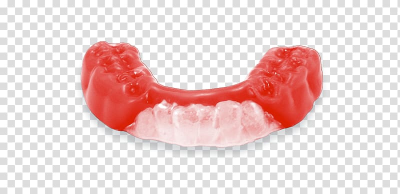 Mouthguard Tooth Athlete Sport Dentures, others transparent background PNG clipart
