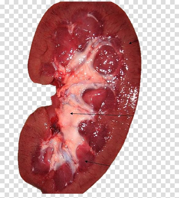 Kidney Nephron Blood Bowman\'s capsule Ureter, real doctors transparent background PNG clipart