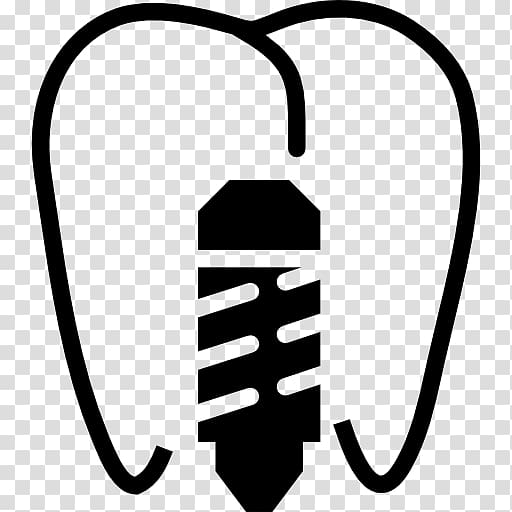 Dental implant Dentistry 歯科, others transparent background PNG clipart