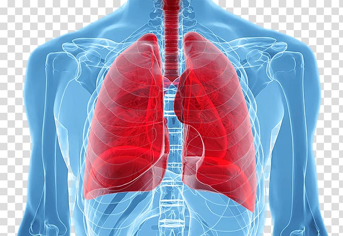 Lung cancer screening Human body, Lung Cancer Staging transparent background PNG clipart