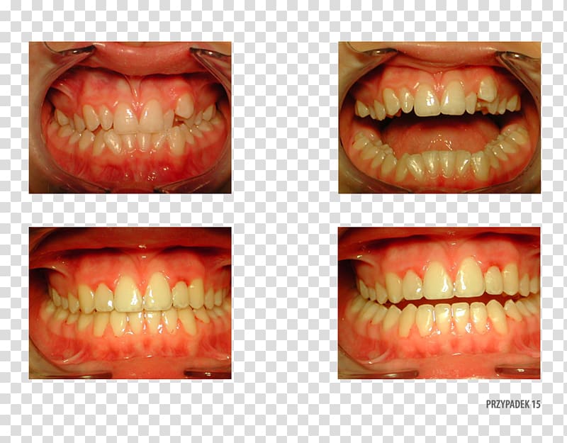 Orange Polska Close-up Therapy Patient, orange transparent background PNG clipart