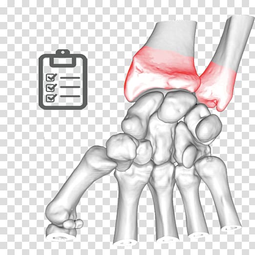 Thumb Elbow Bone Ulnar nerve Joint, stale transparent background PNG clipart