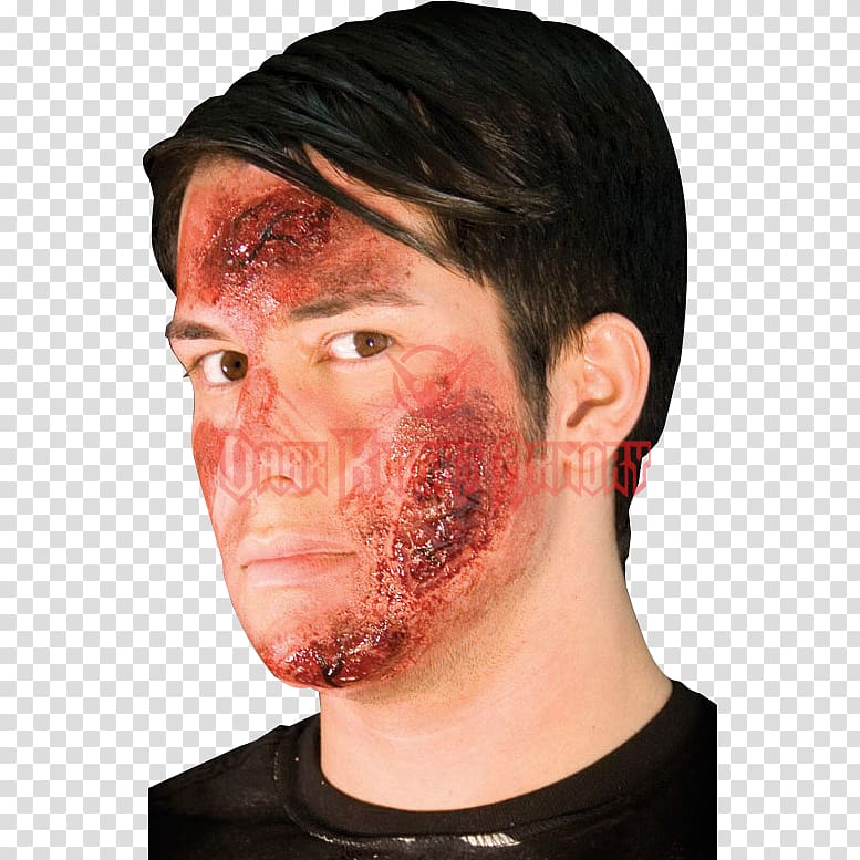 Road rash Prosthesis Wound Skin rash Abrasion, Wound transparent background PNG clipart