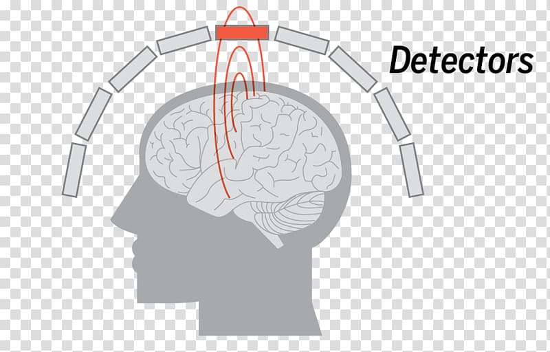 Brain mapping Magnetoencephalography Neuroimaging Magnetic field, brain coronal plane transparent background PNG clipart