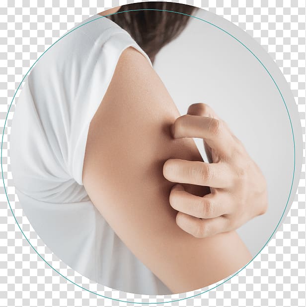 Itch La Peau Dermatology: Zaina Rashid, DO, FAOCD, FAAD Skin rash Tinea cruris Symptom, arm transparent background PNG clipart