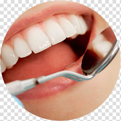 Cosmetic dentistry Oral hygiene Dental surgery, orthodontics surgery transparent background PNG clipart