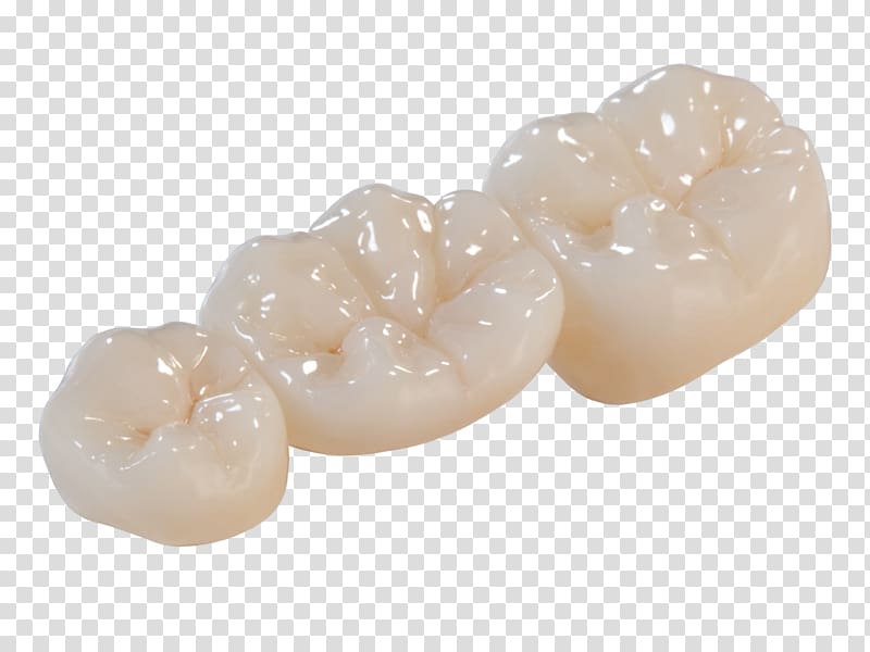 Crown Bridge Zirconium dioxide Dentistry Dental laboratory, crown transparent background PNG clipart