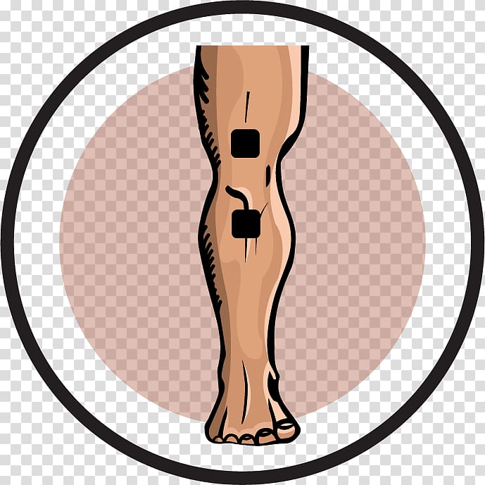 Knee pain Transcutaneous electrical nerve stimulation Electrical muscle stimulation Electrode, transparent background PNG clipart