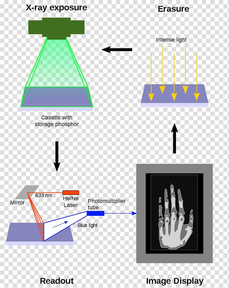 stimulated luminescence Computed Radiography Industrial computed tomography, others transparent background PNG clipart