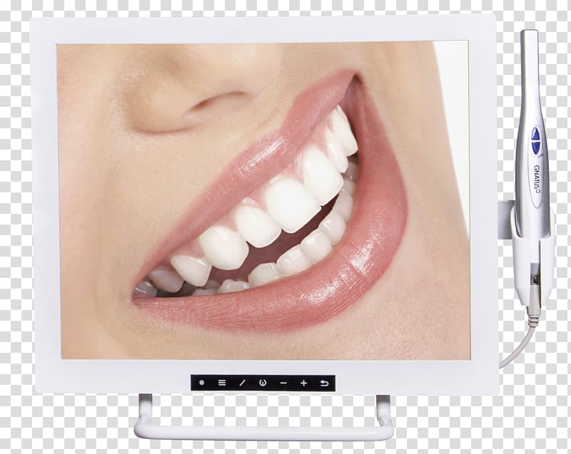 Cosmetic dentistry Oral hygiene Dental implant, Dental Technology transparent background PNG clipart