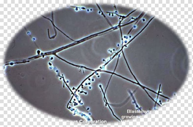 Blastomyces dermatitidis Fungus Blastomycosis White piedra Microscopy, microscope transparent background PNG clipart