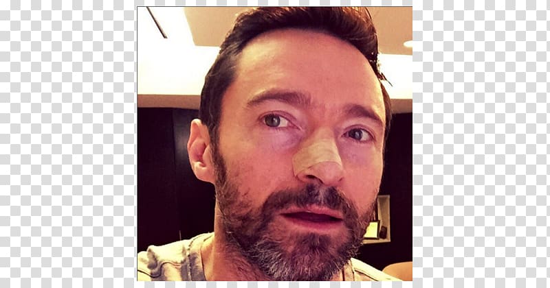 Hugh Jackman The Wolverine Sunscreen Skin cancer Actor, hugh jackman transparent background PNG clipart