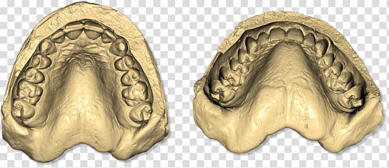 Dental impression Dentistry scanner Dental implant Tooth, others transparent background PNG clipart