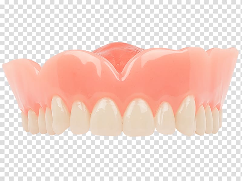 Tooth Dentures Dentistry Aspen Dental, crown transparent background PNG clipart