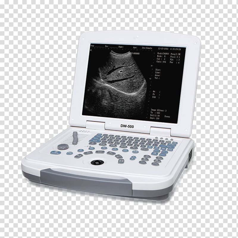 Ultrasonography 3D ultrasound Medicine Medical Equipment, scanner transparent background PNG clipart
