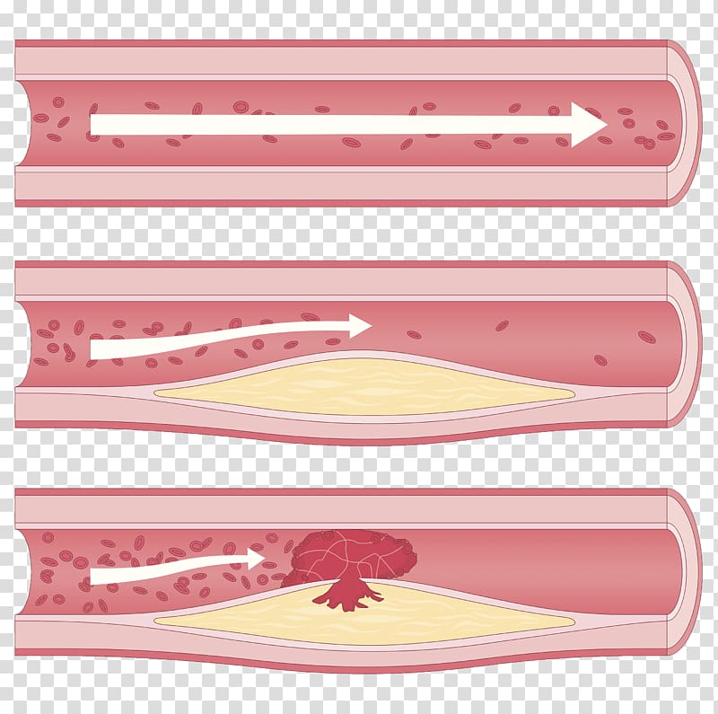 cholesterol arteriosclerosis transparent background PNG clipart