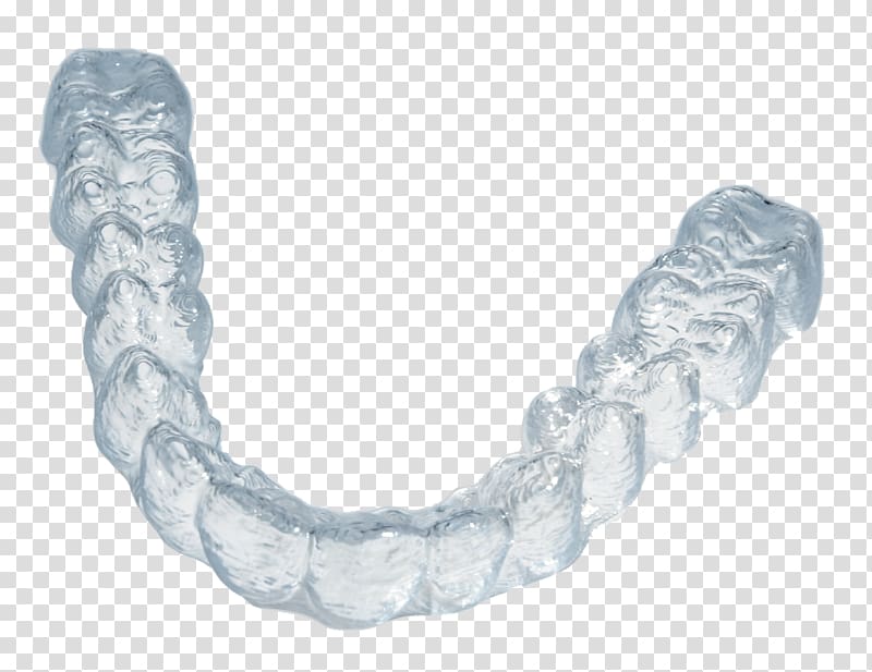Clear aligners Retainer Orthodontics Dentistry Dental braces, the little fresh transparent background PNG clipart