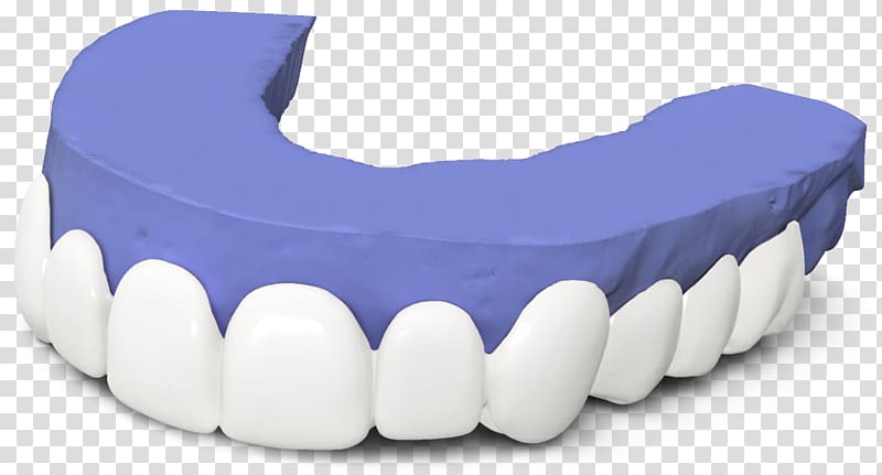 Tooth Veneer Dentistry Dental laboratory, others transparent background PNG clipart