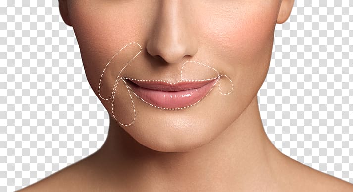 Lip augmentation Restylane Wrinkle Botulinum toxin, Lip Augmentation transparent background PNG clipart