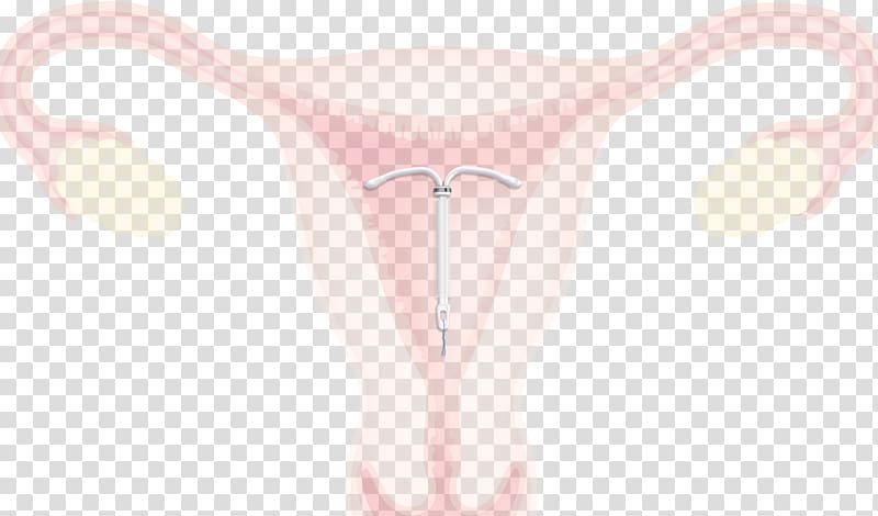 Intrauterine device Kyleena Uterus Progestin IUD Levonorgestrel, sperm condom transparent background PNG clipart