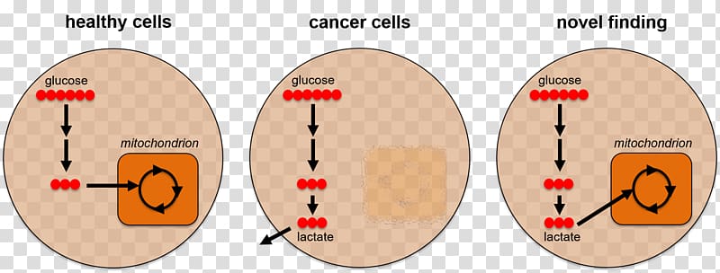 Cancer cell Metabolism Metabolomics, cute cancer cancer cell details transparent background PNG clipart