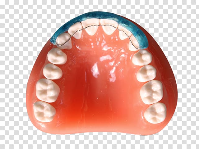 Digital dentistry Diagnostic wax-up CAD/CAM dentistry Tooth, Damon transparent background PNG clipart