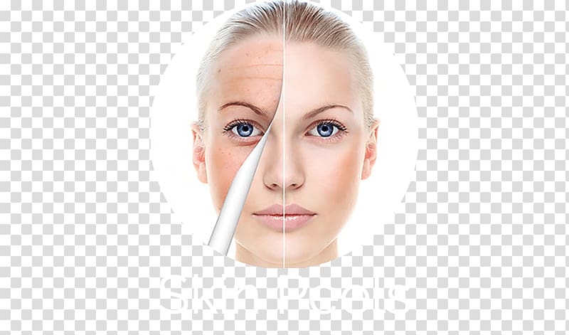 Facial Chemical peel Wrinkle Face Anti-aging cream, Face transparent background PNG clipart