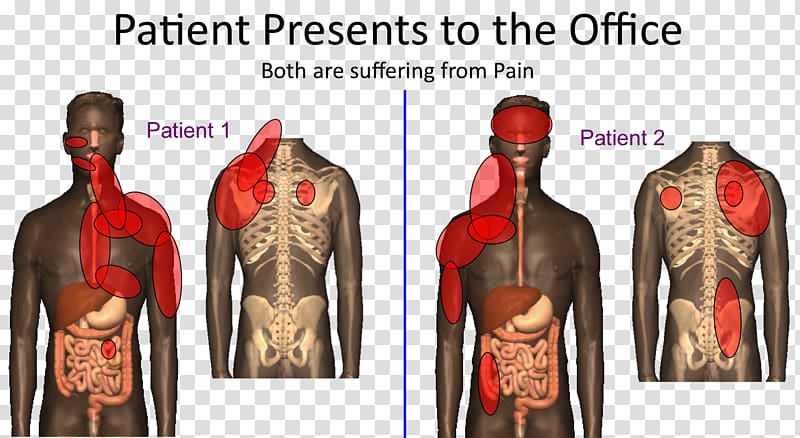 Referred pain Shoulder problem Liver Muscle, somatic transparent background PNG clipart