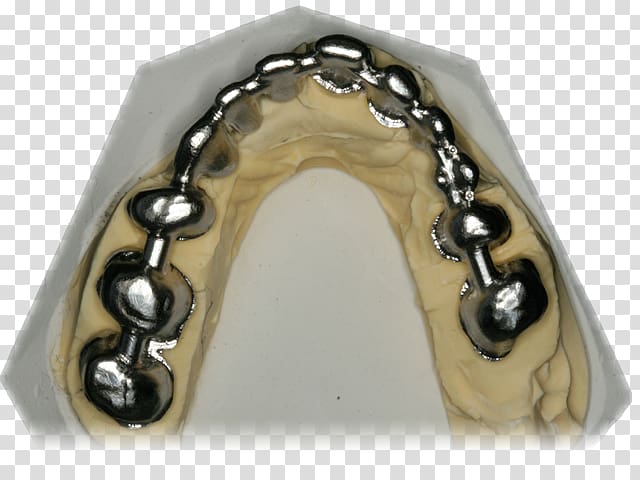 Metal Body Jewellery, dental bridge transparent background PNG clipart