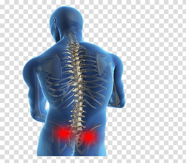 Low back pain Spinal disc herniation Therapy Human back, book spine transparent background PNG clipart