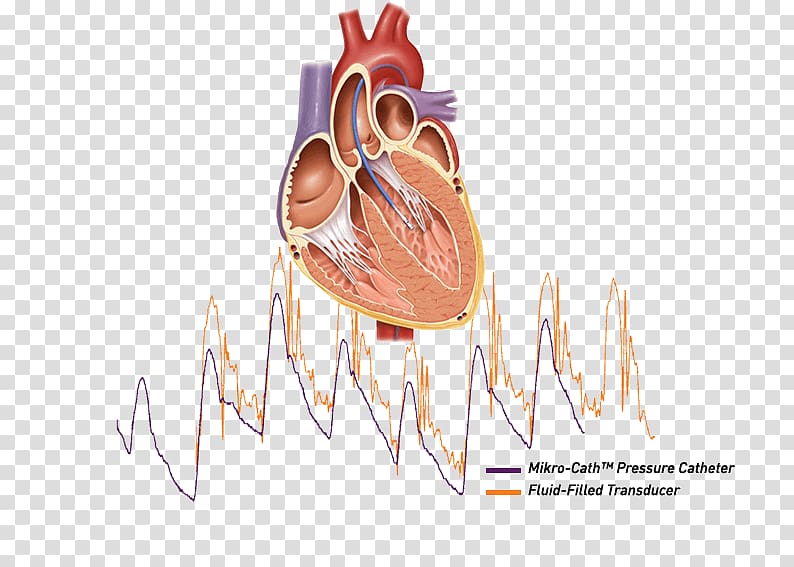 Cardiac catheterization Heart Ailment Cath lab, heart transparent background PNG clipart