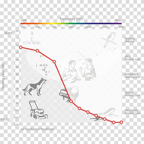 Audiogram Cochlear implant Audiometry Hearing loss MED-EL, acoustic stimulation transparent background PNG clipart