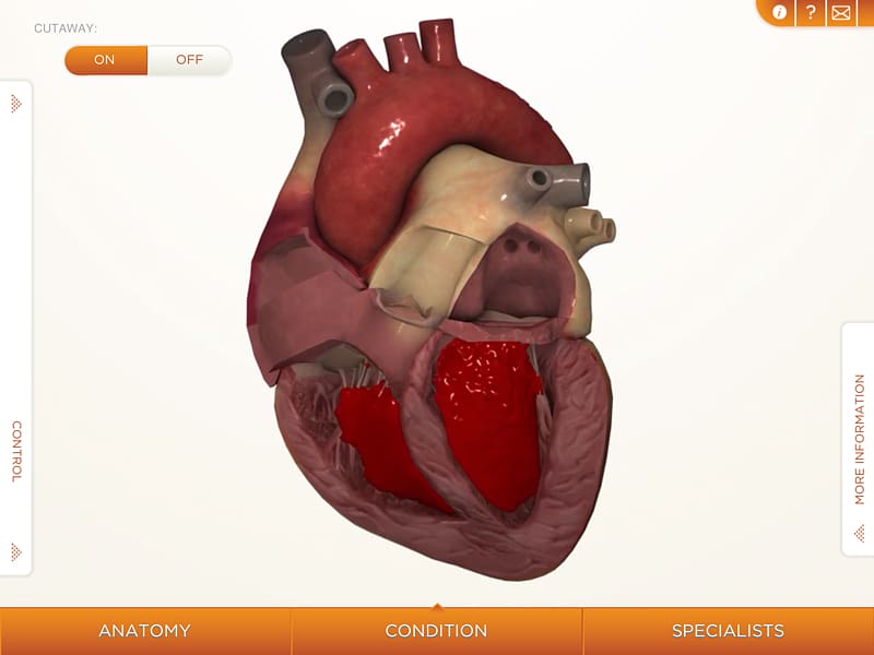 Heart Cardiovascular disease Human body Anatomy Muscle, Heart transparent background PNG clipart