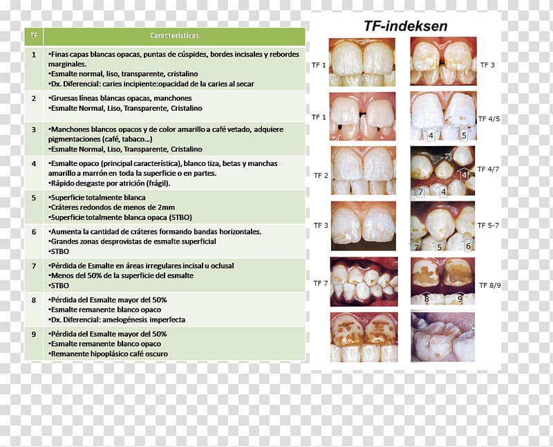 Advertising Dental fluorosis Dentistry Brochure, indice transparent background PNG clipart