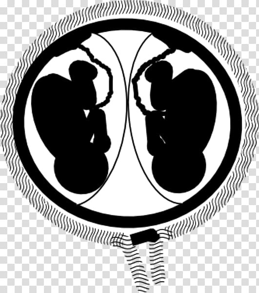 Twin Pregnancy Fetus Uterus , twins transparent background PNG clipart