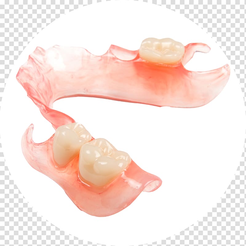 Dentures Dental laboratory Dentistry Prosthesis, Spoof Of Dentures transparent background PNG clipart
