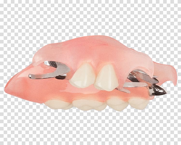 Tooth Dentures Removable partial denture Dentistry Crown, Top Angle transparent background PNG clipart