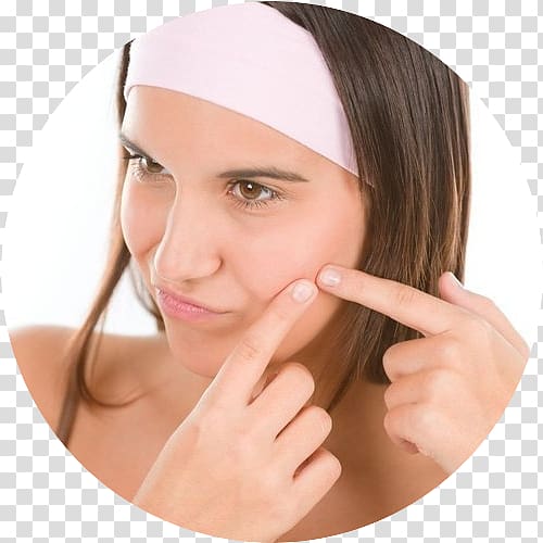 Acne Pimple Scar Skin care Tretinoin, Scar transparent background PNG clipart