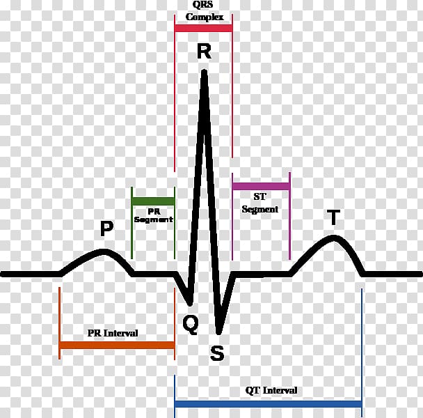 QT interval Long QT syndrome PR interval QRS complex Electrocardiography, Heart rate electrocardiography transparent background PNG clipart