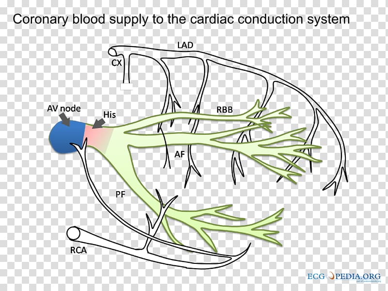 Ischemia Cardiac muscle Coronary artery disease Acute myocardial infarction Nutrient, others transparent background PNG clipart