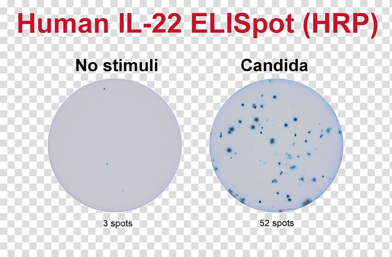 ELISPOT Assay B cell Granzyme Secretion, others transparent background PNG clipart