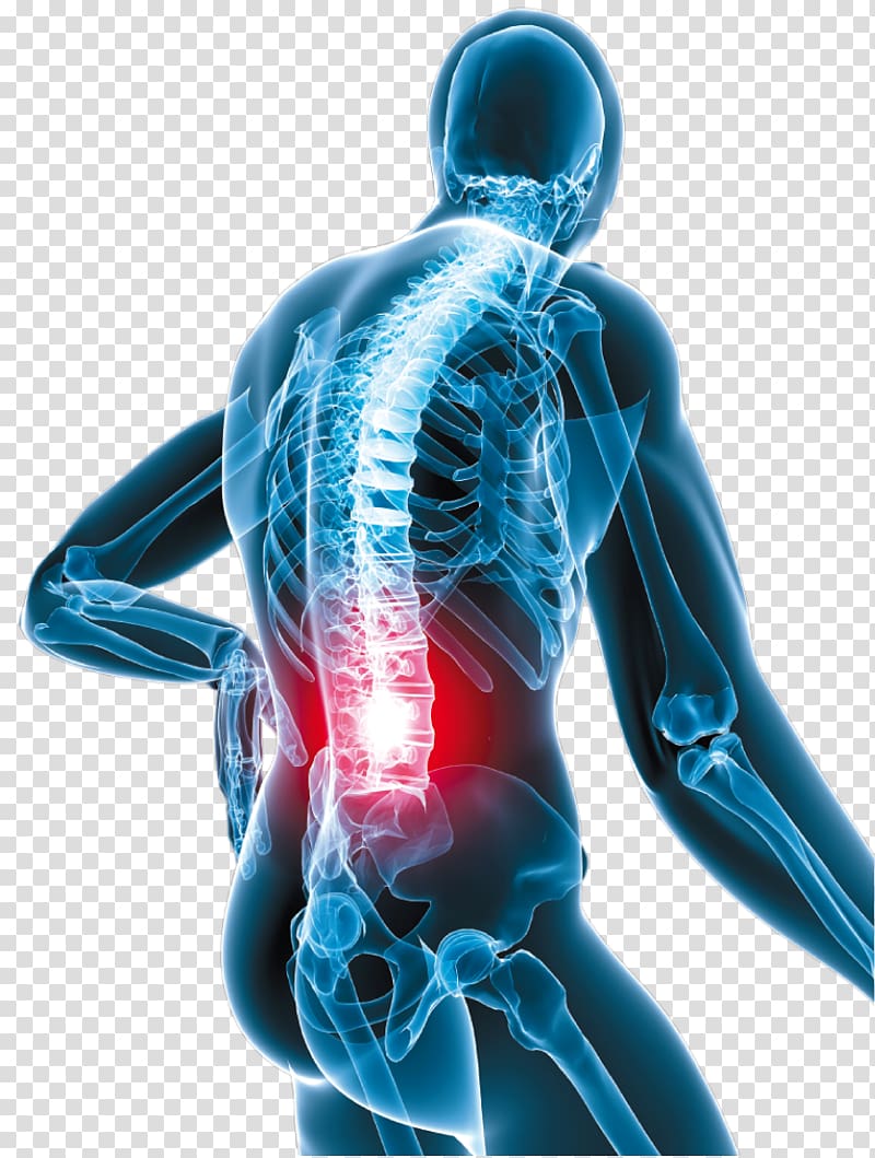 Low back pain Neck pain Oxycodone Human back, vertebral transparent background PNG clipart