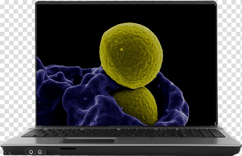 MRSA Super bug Immune system Bacteria Medicine Infection, health transparent background PNG clipart