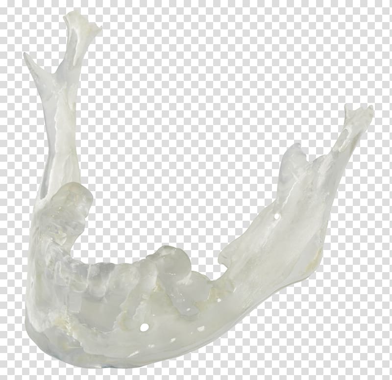 Dental Crafters, Inc. 3D printing Dental laboratory Dental implant, Dental Laboratory transparent background PNG clipart