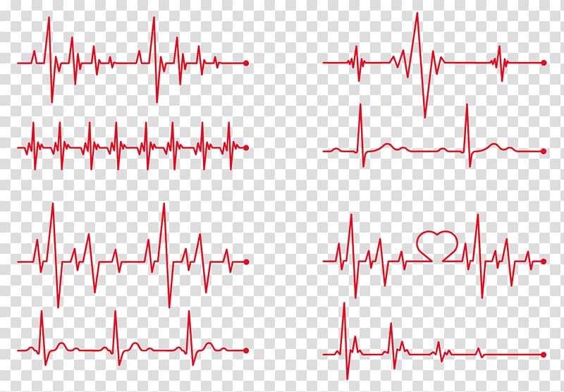 Electrocardiograph - Đây là công cụ y tế quan trọng để theo dõi sức khỏe của tim mạch. Hãy cùng tìm hiểu về chi tiết thiết bị và nguyên lý hoạt động của nó trong hình ảnh để hiểu rõ hơn về sức khỏe của chính mình.