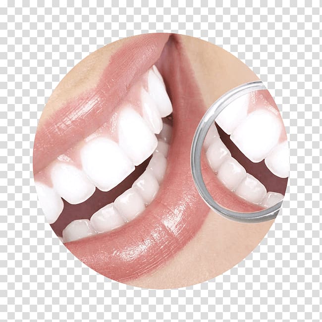 Cosmetic dentistry Tooth Periodontology, Restorative Dentistry transparent background PNG clipart
