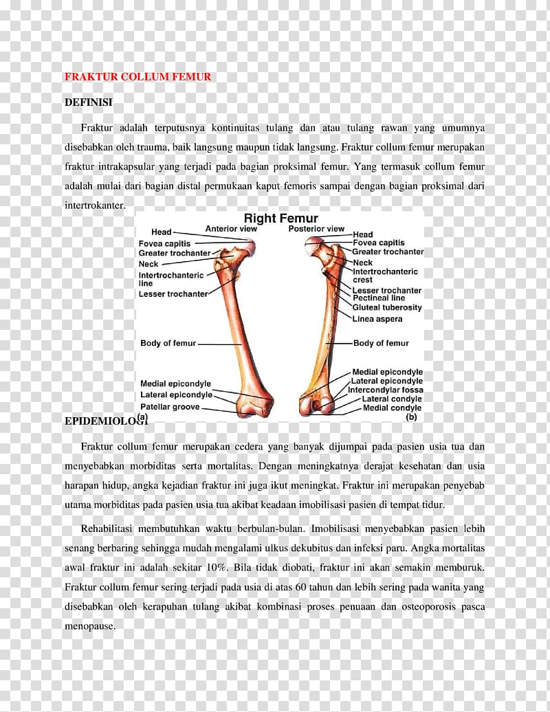 Femur Bone fracture Greater trochanter Anatomy, others transparent background PNG clipart