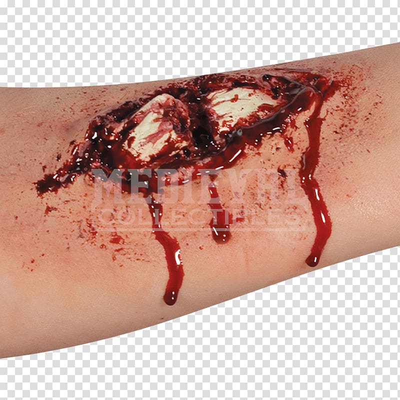 Bone fracture Prosthesis Wound Arm, Wound transparent background PNG clipart