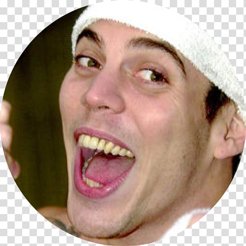 Steve-O Veneer Jackass: The Movie Celebrity Dentistry, zhang tooth grin transparent background PNG clipart
